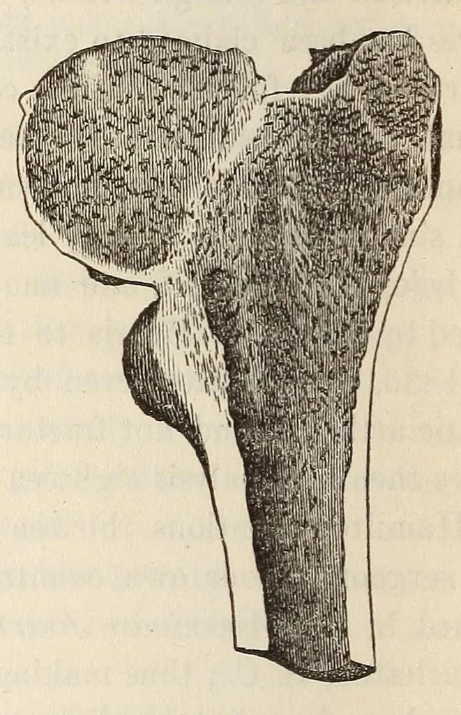 An illustration from The American journal of the medical sciences, 1827, leaf 388
