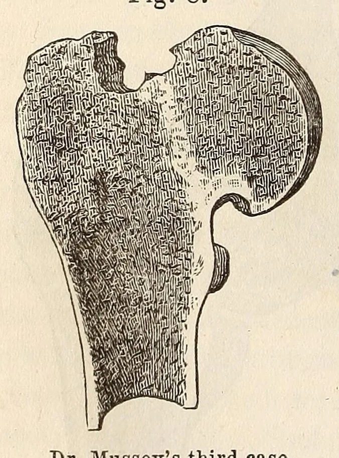 An illustration from The American journal of the medical sciences, 1827, leaf 388