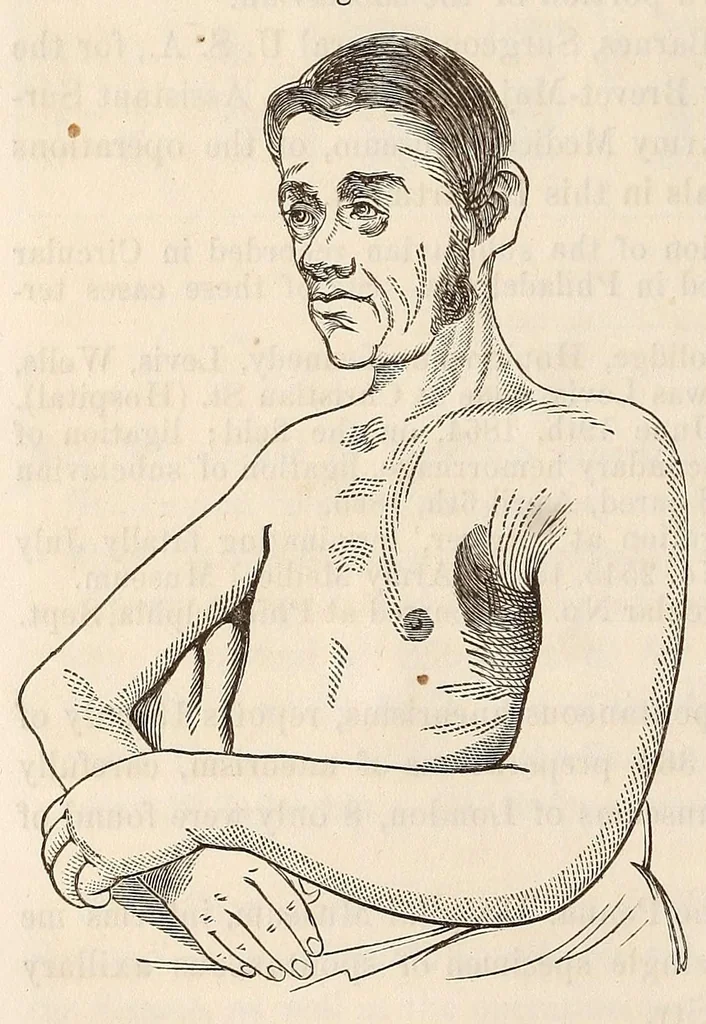 An illustration from The American journal of the medical sciences, 1827, leaf 78