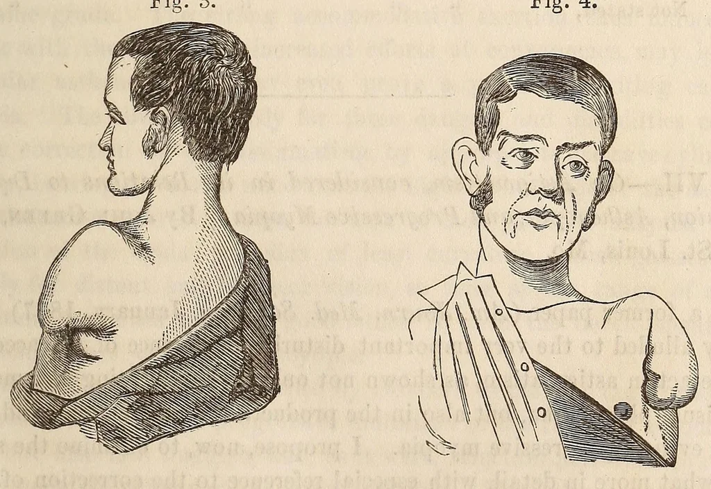 An illustration from The American journal of the medical sciences, 1827, leaf 87