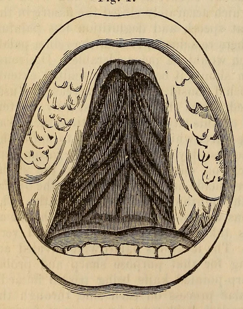 An illustration from The American journal of the medical sciences, 1827, leaf 124