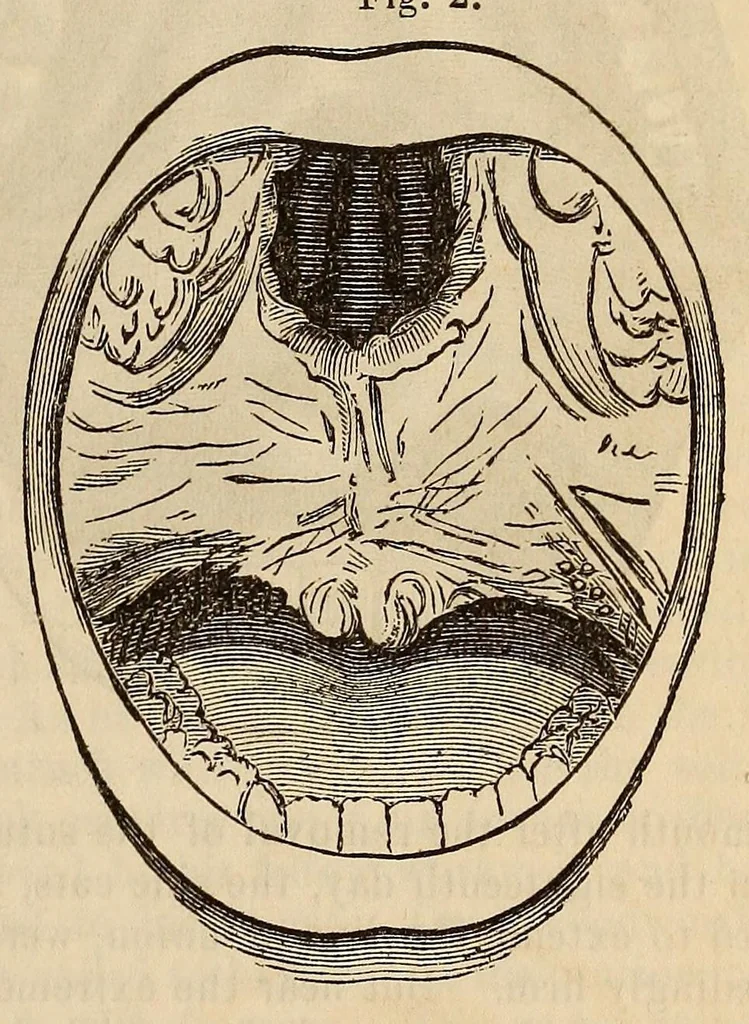 An illustration from The American journal of the medical sciences, 1827, leaf 125
