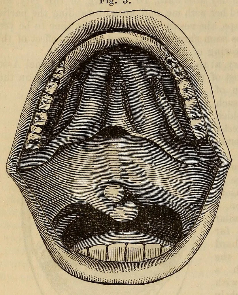 An illustration from The American journal of the medical sciences, 1827, leaf 126