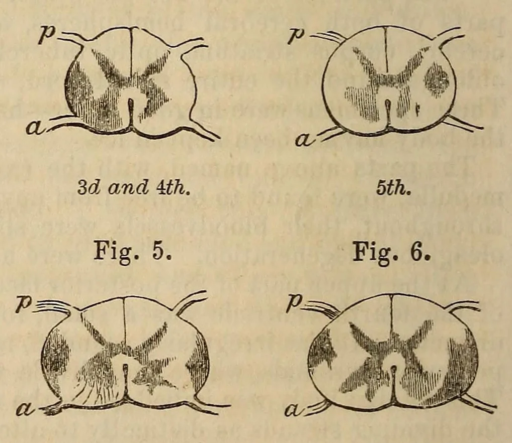 An illustration from The American journal of the medical sciences, 1827, leaf 146