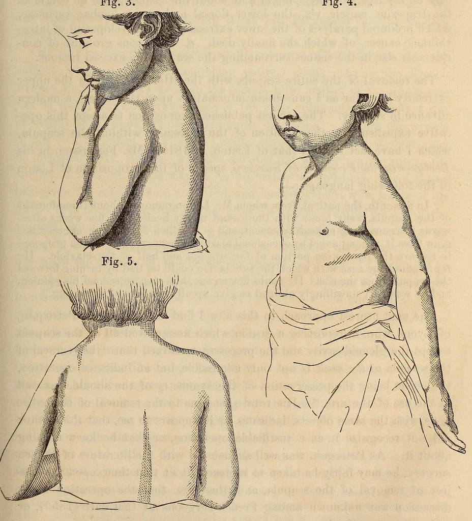 An illustration from The American journal of the medical sciences, 1827, leaf 363