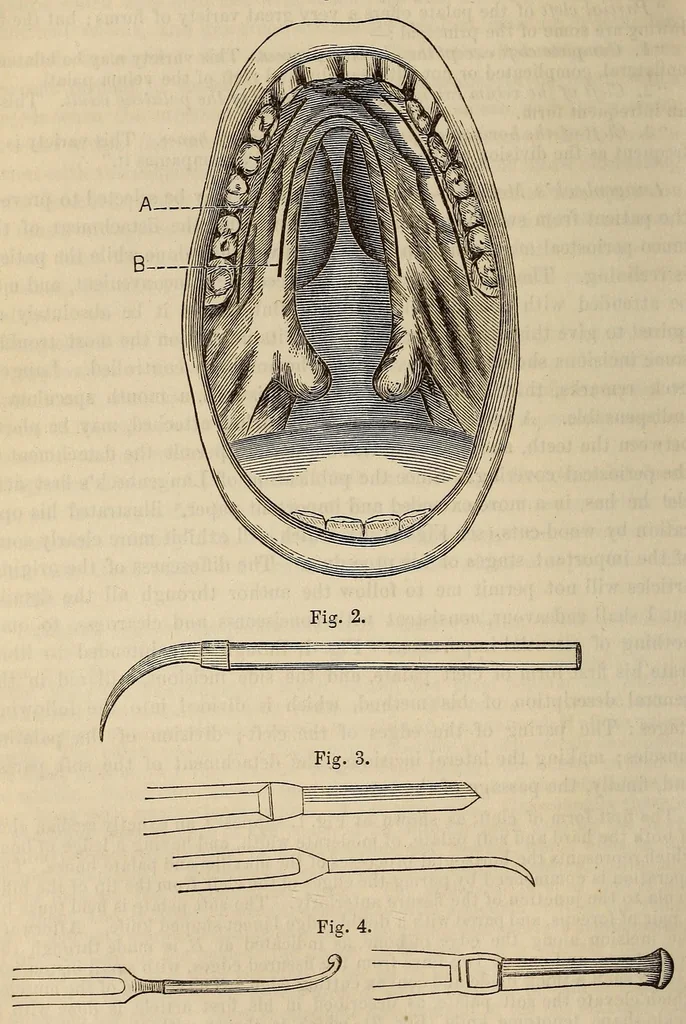 An illustration from The American journal of the medical sciences, 1827, leaf 388