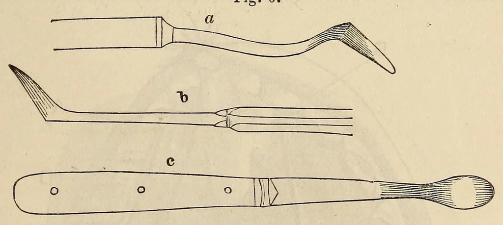 An illustration from The American journal of the medical sciences, 1827, leaf 389
