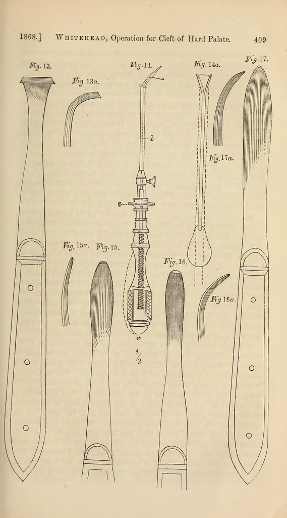 An illustration from The American journal of the medical sciences, 1827, leaf 409