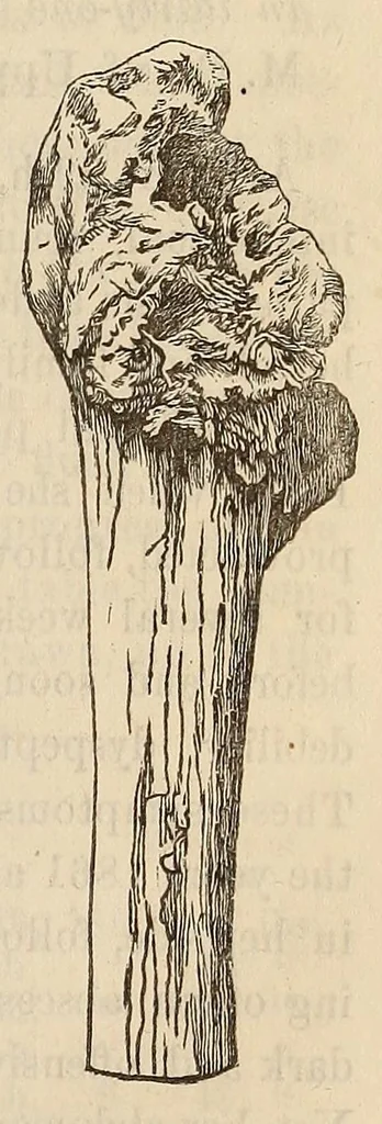 An illustration from The American journal of the medical sciences, 1827, leaf 99