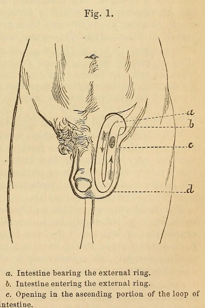 An illustration from The American journal of the medical sciences, 1827, leaf 411