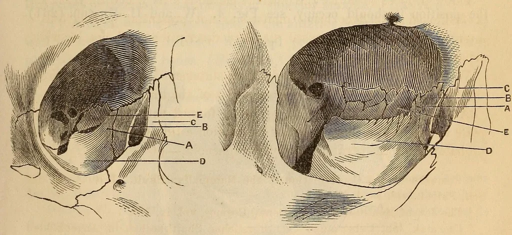 An illustration from The American journal of the medical sciences, 1827, leaf 121
