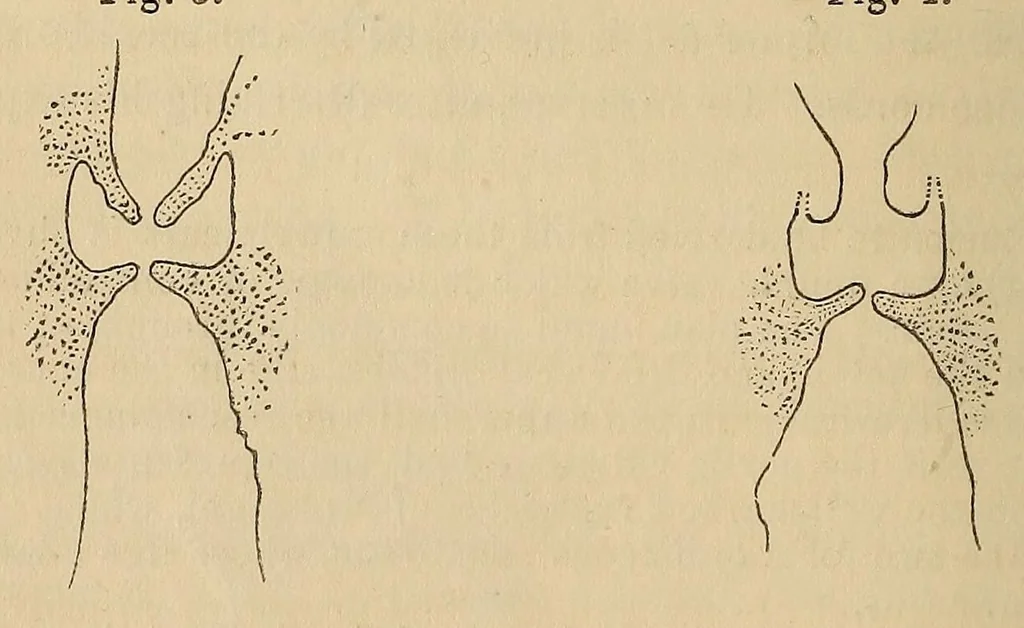 An illustration from The American journal of the medical sciences, 1827, leaf 308