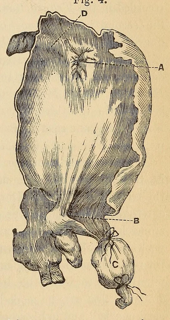An illustration from The American journal of the medical sciences, 1827, leaf 369