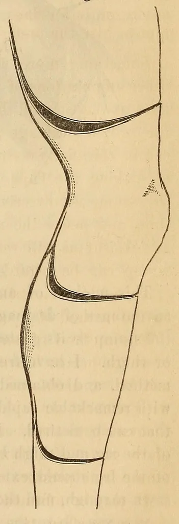 An illustration from The American journal of the medical sciences, 1827, leaf 39