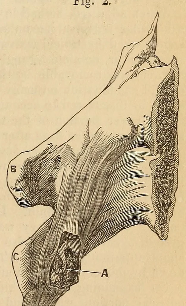 An illustration from The American journal of the medical sciences, 1827, leaf 413