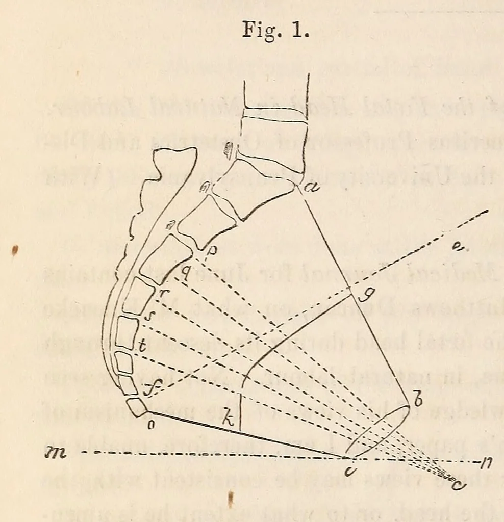 An illustration from The American journal of the medical sciences, 1827, leaf 324
