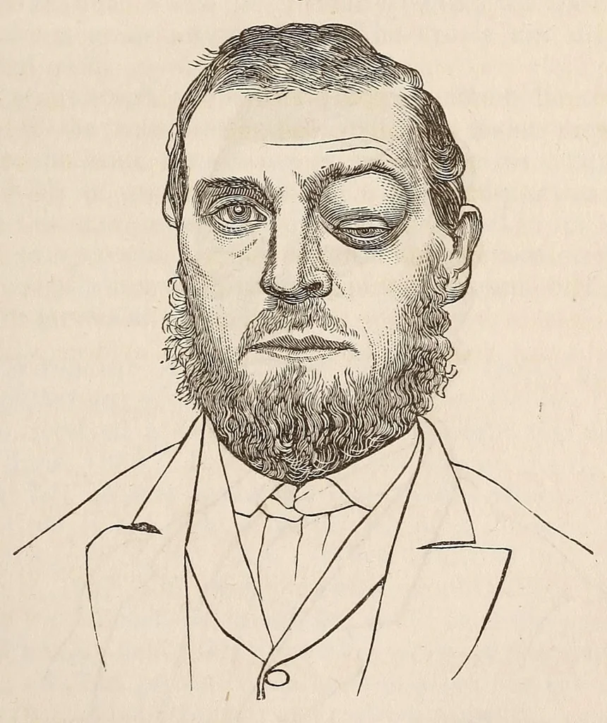 An illustration from The American journal of the medical sciences, 1827, leaf 45