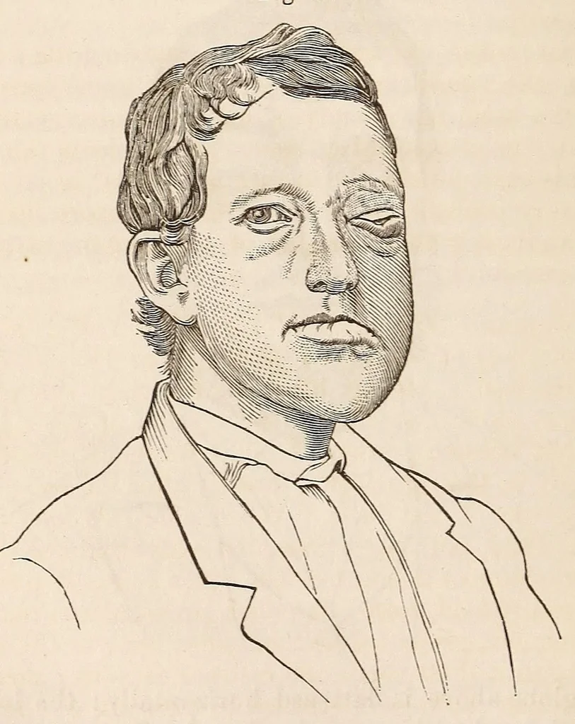 An illustration from The American journal of the medical sciences, 1827, leaf 46