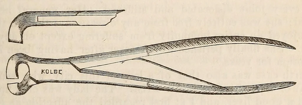 An illustration from The American journal of the medical sciences, 1827, leaf 53