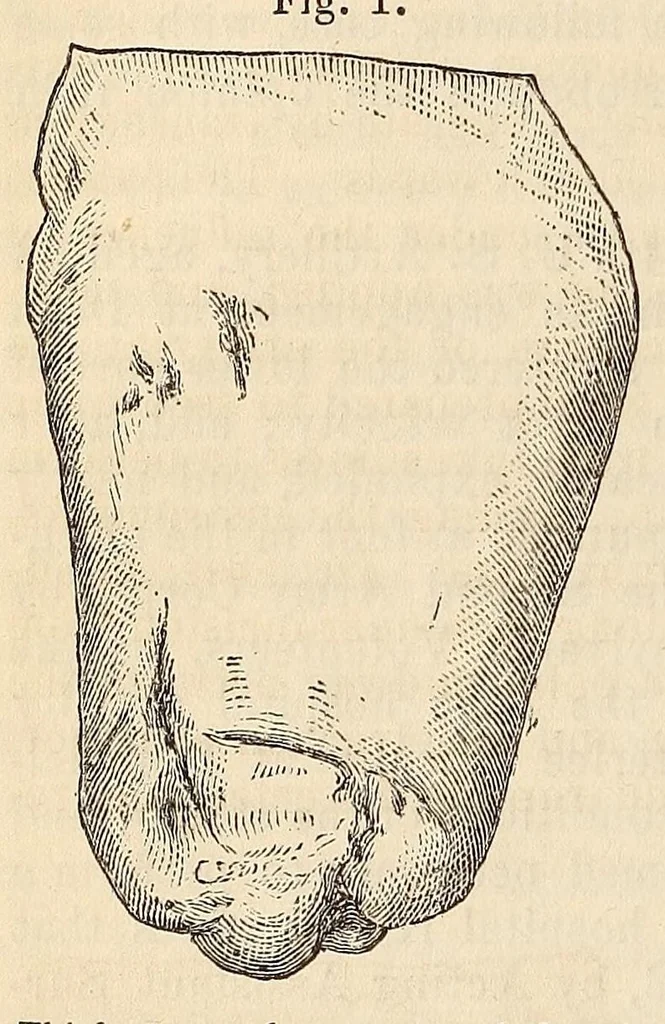 An illustration from The American journal of the medical sciences, 1827, leaf 146