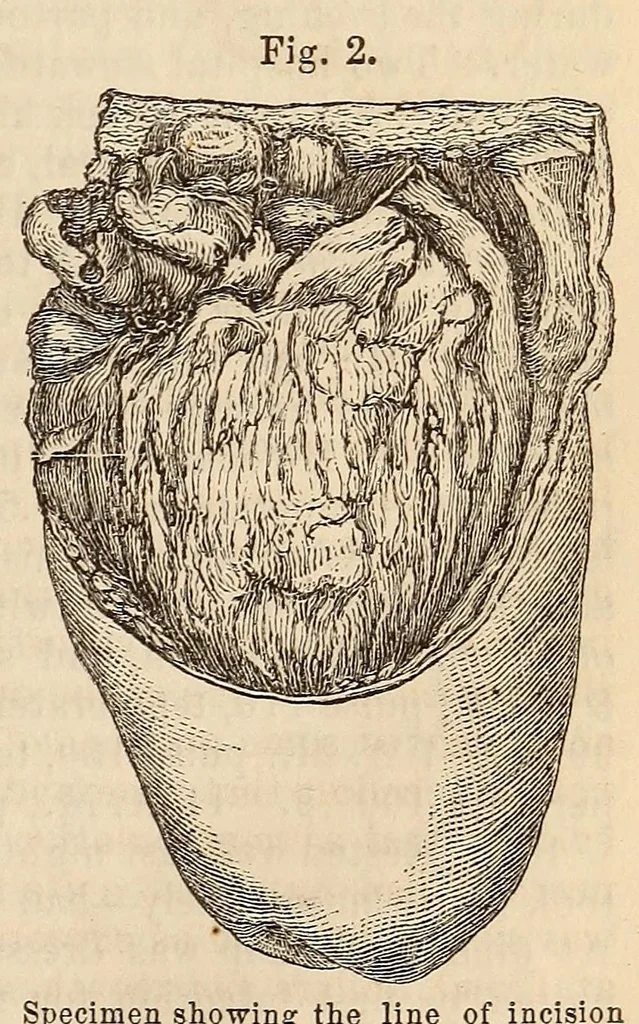 An illustration from The American journal of the medical sciences, 1827, leaf 147