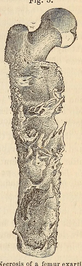An illustration from The American journal of the medical sciences, 1827, leaf 151