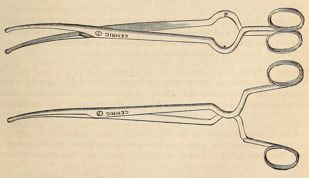 An illustration from The American journal of the medical sciences, 1827, leaf 397