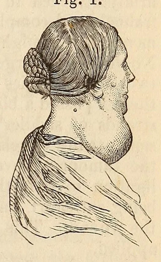 An illustration from The American journal of the medical sciences, 1827, leaf 85