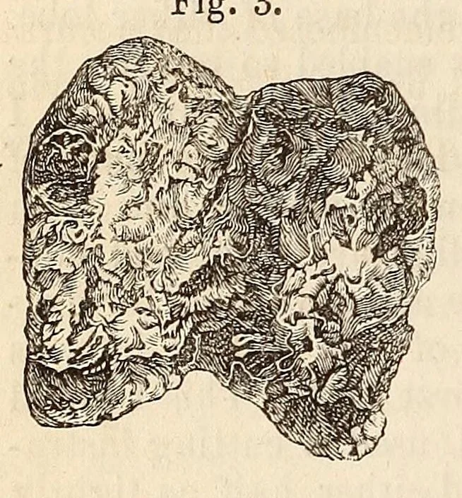 An illustration from The American journal of the medical sciences, 1827, leaf 90