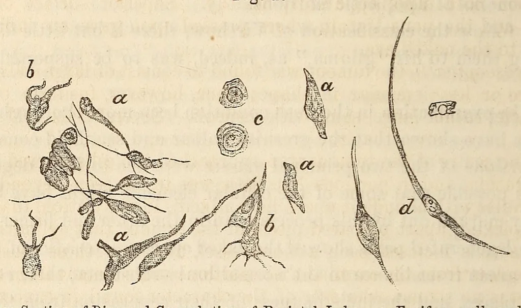An illustration from The American journal of the medical sciences, 1827, leaf 94