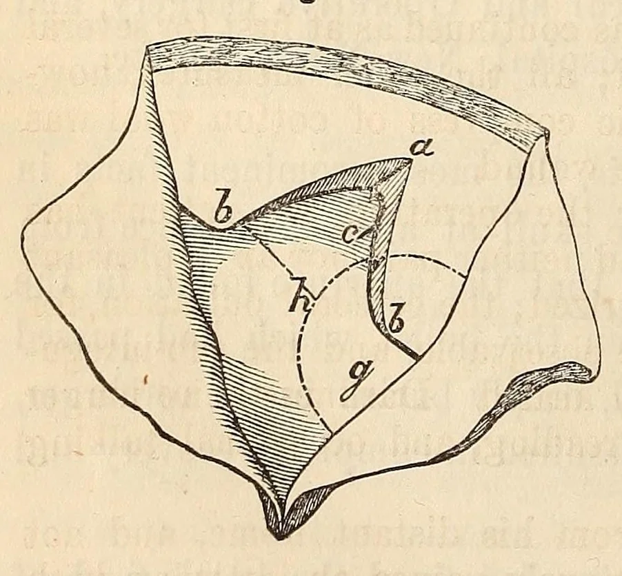 An illustration from The American journal of the medical sciences, 1827, leaf 384
