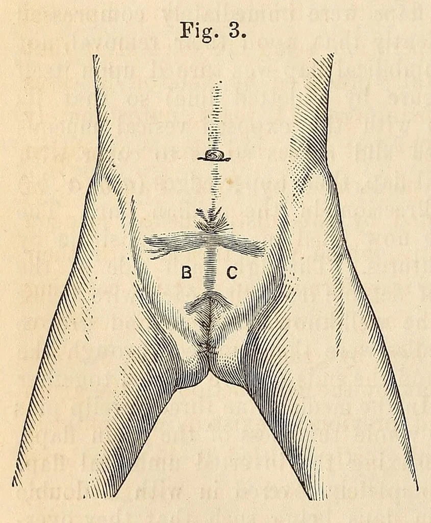 An illustration from The American journal of the medical sciences, 1827, leaf 74