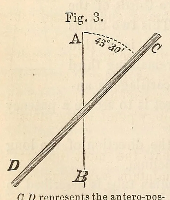An illustration from The American journal of the medical sciences, 1827, leaf 360