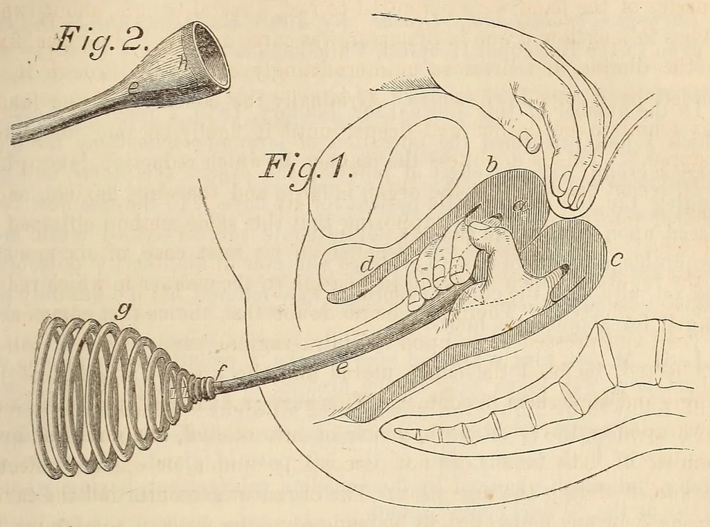 An illustration from The American journal of the medical sciences, 1827, leaf 403