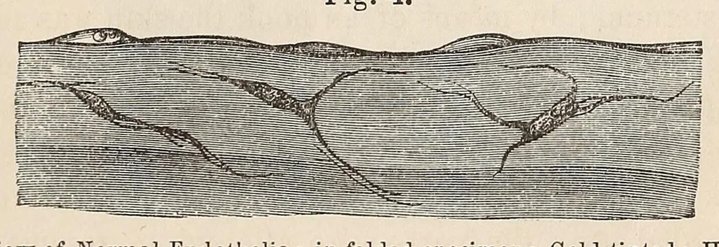 An illustration from The American journal of the medical sciences, 1827, leaf 319