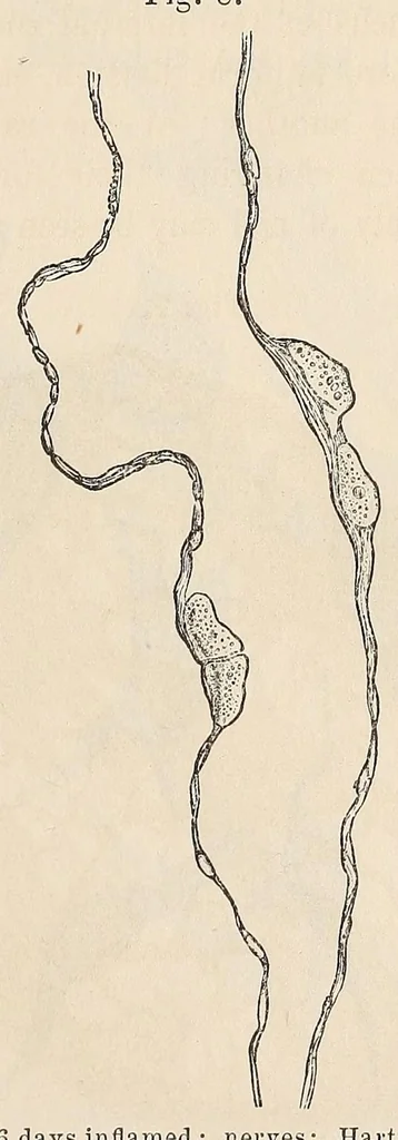 An illustration from The American journal of the medical sciences, 1827, leaf 321