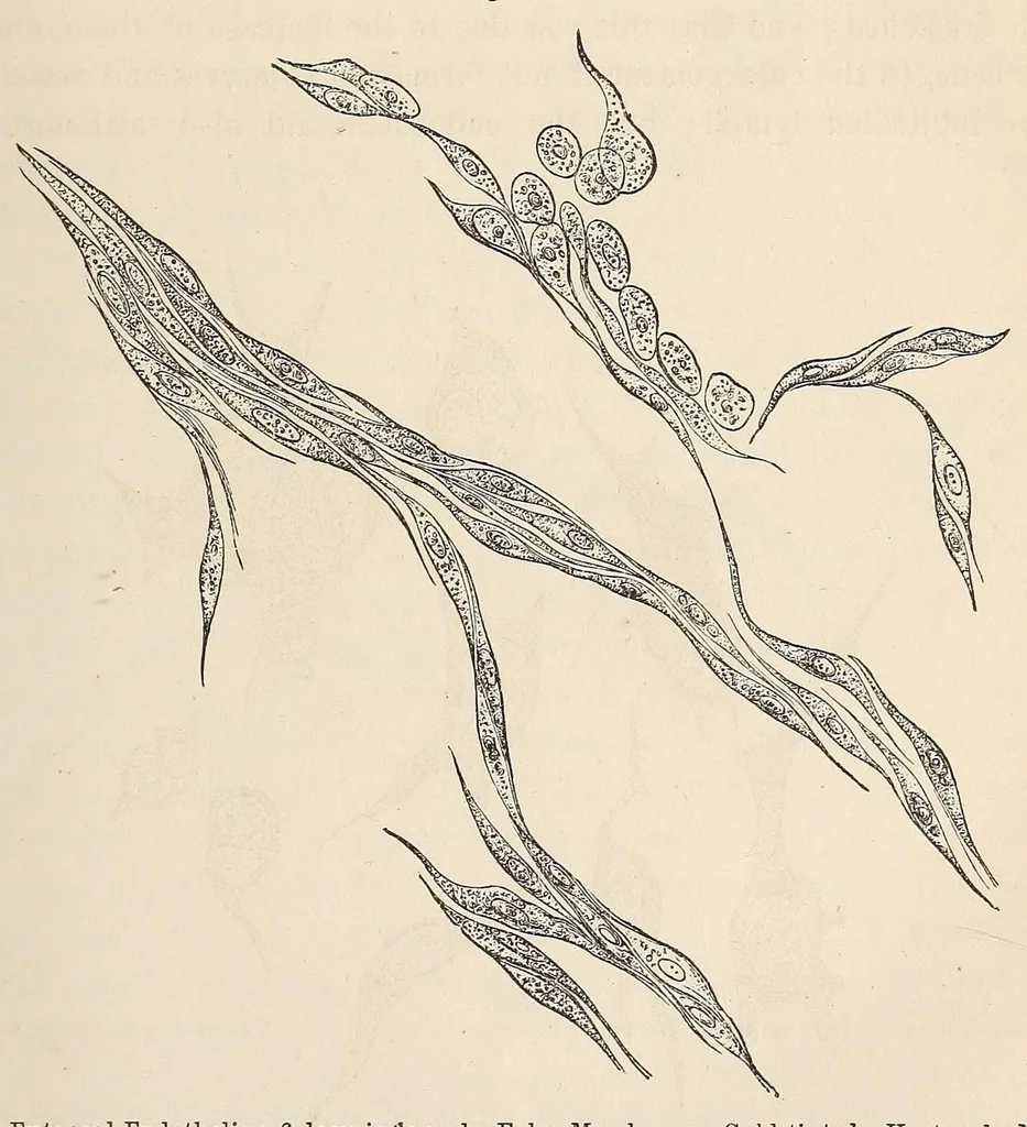 An illustration from The American journal of the medical sciences, 1827, leaf 323