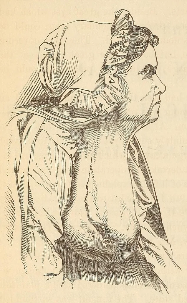An illustration from The American journal of the medical sciences, 1827, leaf 26