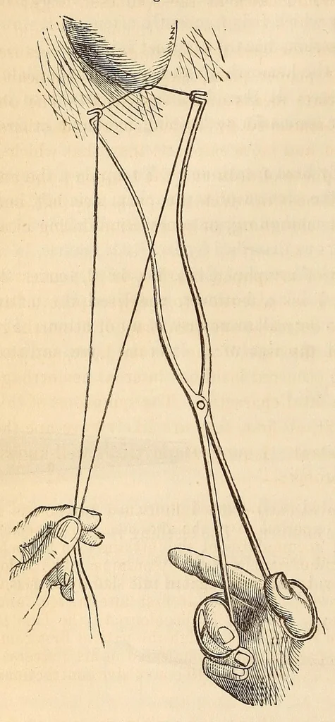 An illustration from The American journal of the medical sciences, 1827, leaf 26