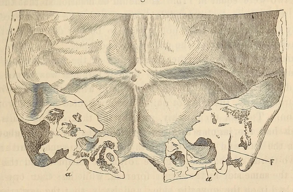 An illustration from The American journal of the medical sciences, 1827, leaf 413
