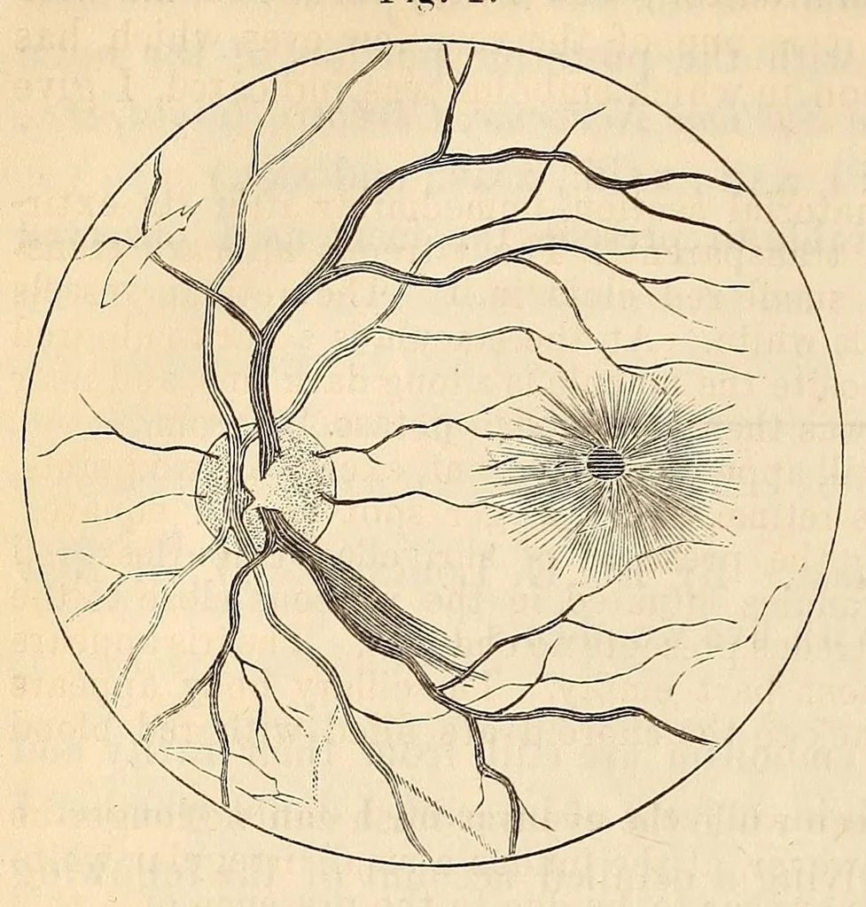 An illustration from The American journal of the medical sciences, 1827, leaf 314