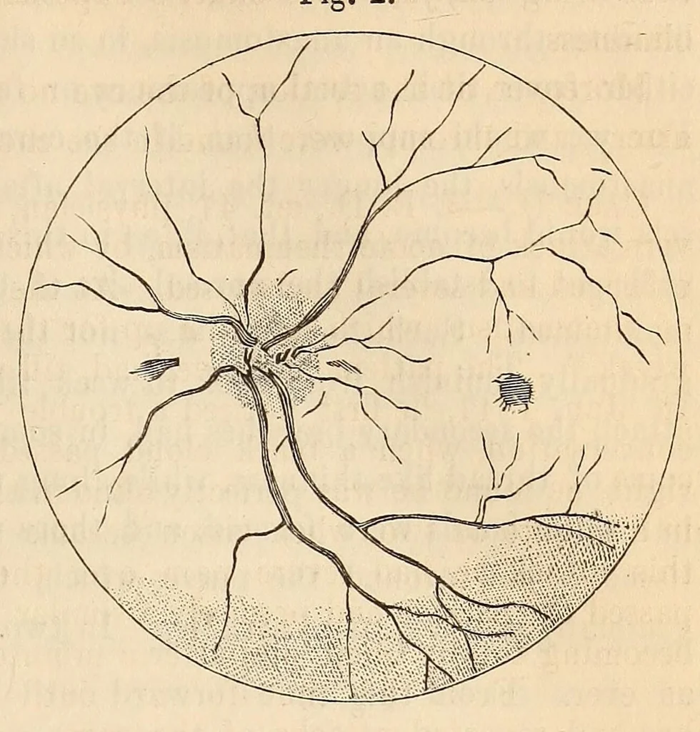An illustration from The American journal of the medical sciences, 1827, leaf 321