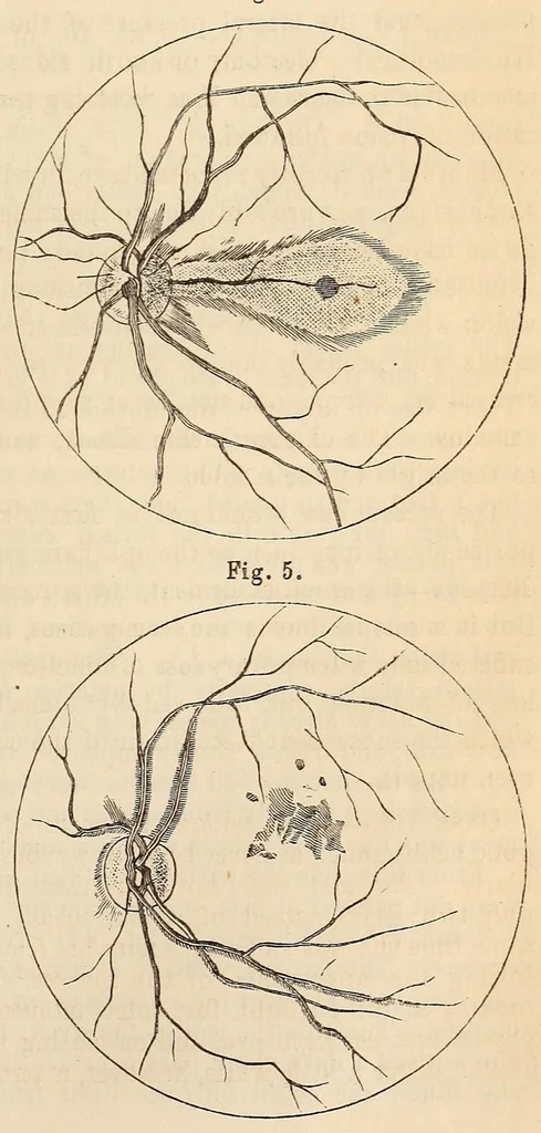 An illustration from The American journal of the medical sciences, 1827, leaf 325