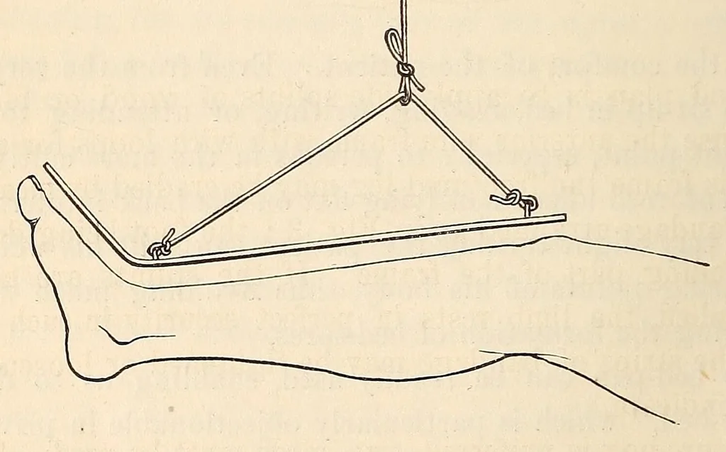 An illustration from The American journal of the medical sciences, 1827, leaf 364