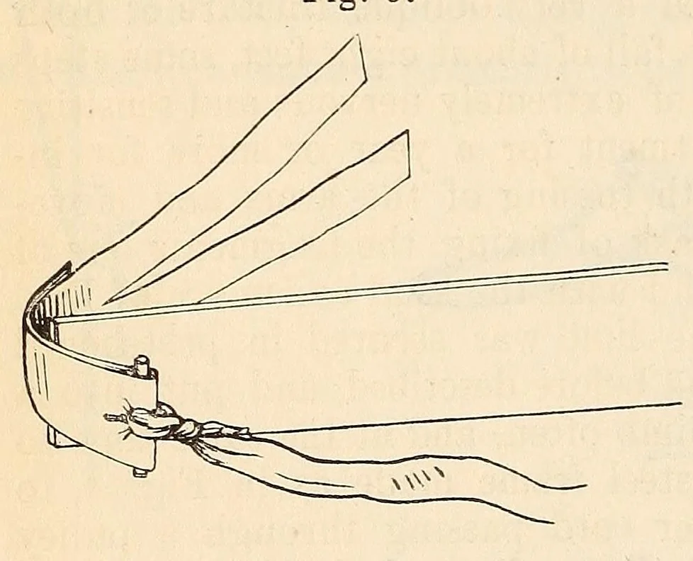 An illustration from The American journal of the medical sciences, 1827, leaf 366