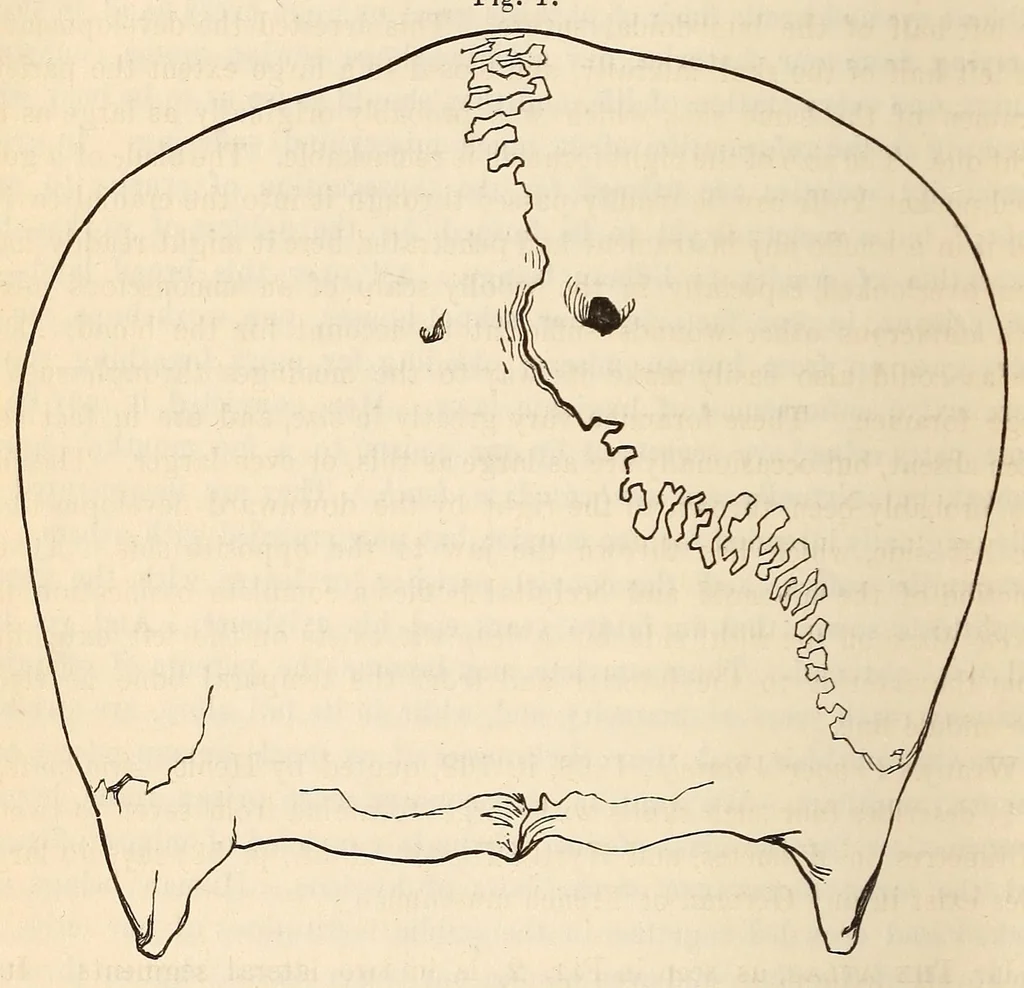 An illustration from The American journal of the medical sciences, 1827, leaf 412