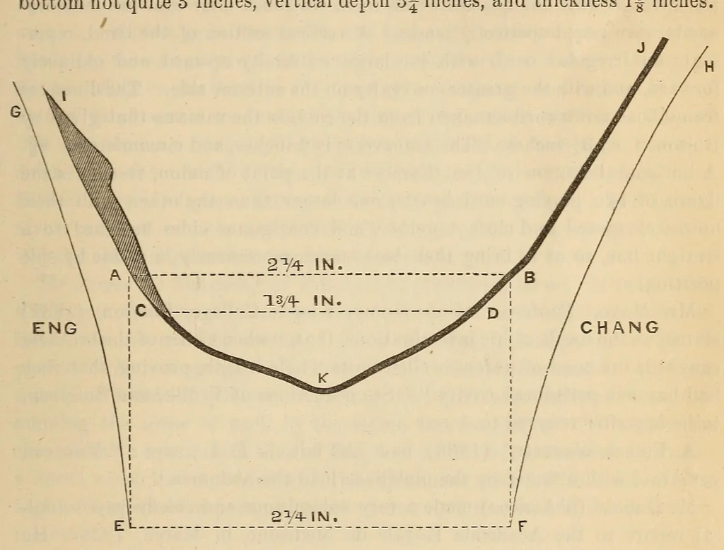 An illustration from The American journal of the medical sciences, 1827, leaf 361