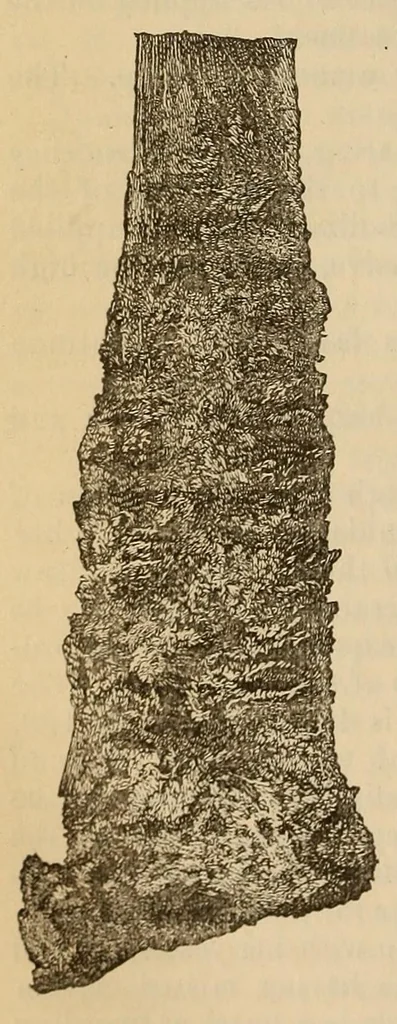 An illustration from The American journal of the medical sciences, 1827, leaf 426