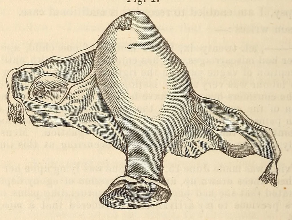 An illustration from The American journal of the medical sciences, 1827, leaf 100
