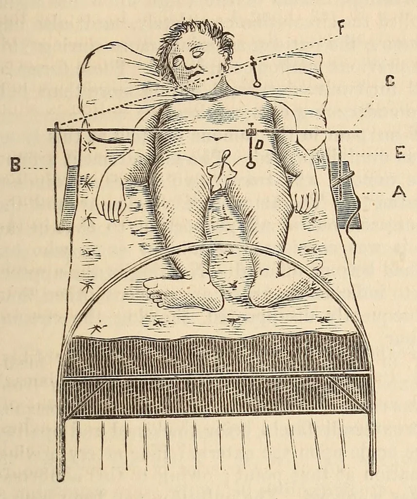 An illustration from The American journal of the medical sciences, 1827, leaf 139